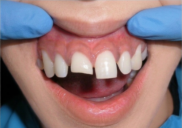 Before treatment