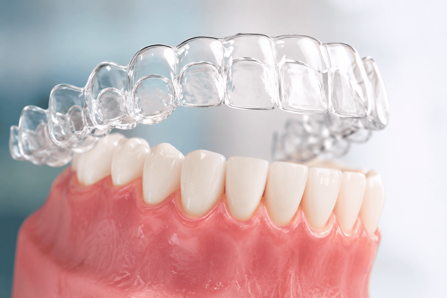 Orthodontics (Aligners)