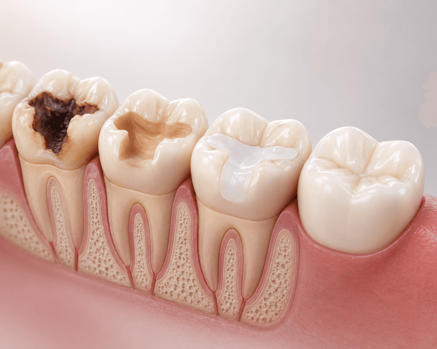 Restorative Dentistry